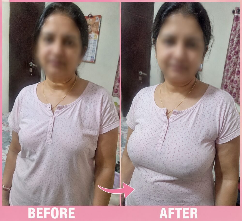 Pooja Singh - पहले और बाद में