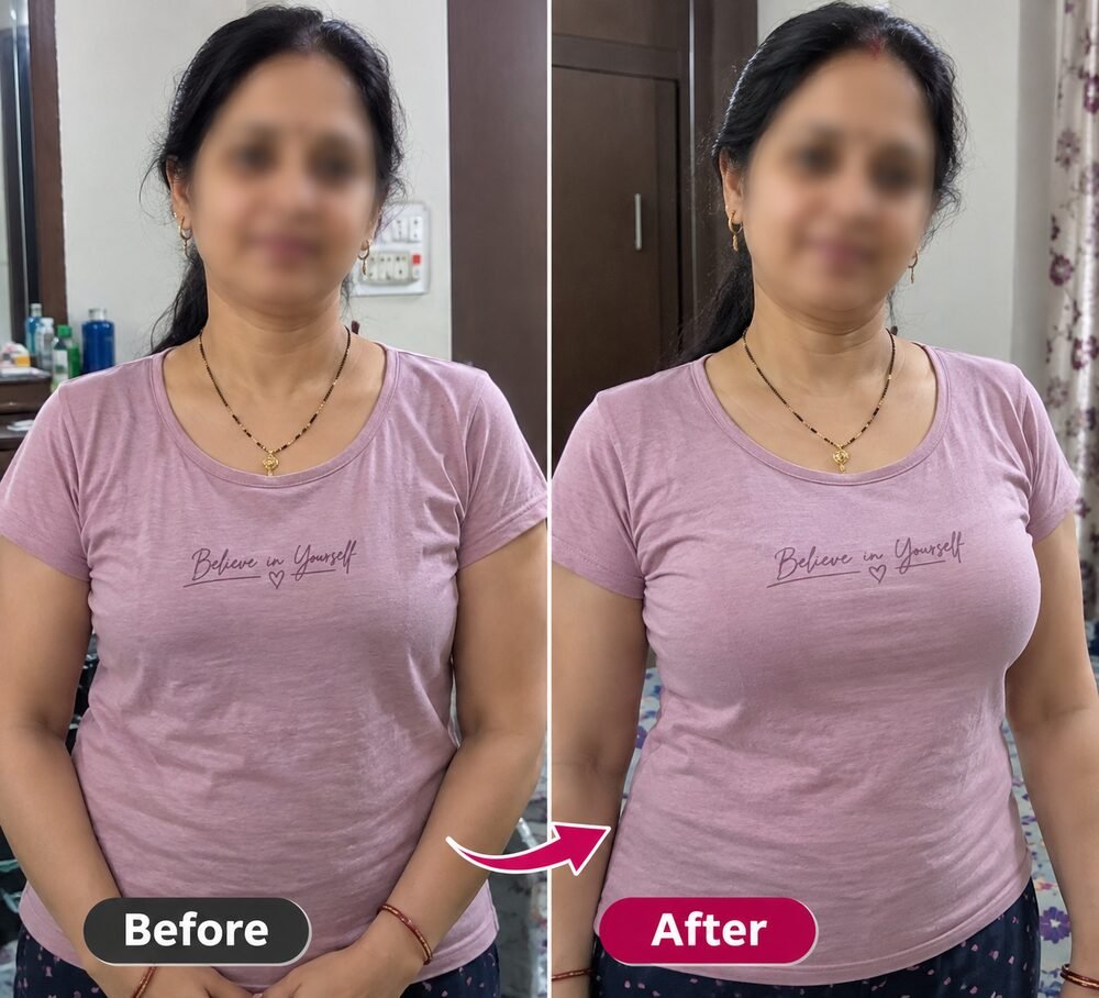 Sonal Bajaj - पहले और बाद में